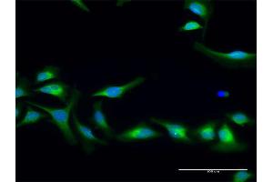 Immunofluorescence of purified MaxPab antibody to PLOD2 on HeLa cell. (PLOD2 antibody  (AA 1-758))