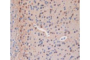 IHC-P analysis of Mouse Brain Tissue, with DAB staining. (PLA2R1 antibody  (AA 1418-1487))