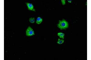 Immunofluorescence staining of Hela cells with ABIN7162449 at 1:100, counter-stained with DAPI. (P2RX7 antibody  (AA 110-247))