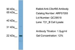 WB Suggested Anti-C9orf95  Antibody Titration: 0. (NMRK1 antibody  (N-Term))