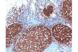 Pax-5 (clone 24) staining on human tonsil. (PAX5 antibody  (AA 151-306))