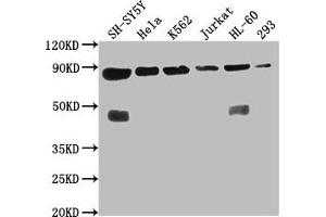 Western Blot Positive WB detected in: SH-SY5Y whole cell lysate, Hela whole cell lysate, K562 whole cell lysate, Jurkat whole cell lysate, HL60 whole cell lysate, 293 whole cell lysate All lanes: YY1AP1 antibody at 1:2000 Secondary Goat polyclonal to rabbit IgG at 1/50000 dilution Predicted band size: 88, 84, 82, 81, 76, 80, 51, 96, 98 kDa Observed band size: 88 kDa (YY1AP1 antibody  (AA 335-466))