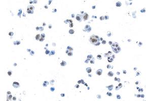 Immunocytochemistry (ICC) image for anti-Bromodomain Containing 3 (BRD3) (AA 676-726) antibody (ABIN7455203) (Recombinant BRD3 antibody  (AA 676-726))
