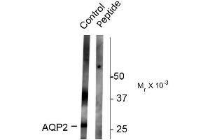 Western blots of rat kidney lysate showing specific immunolabeling of the ~ 29k and 37k glycosylated form of the AQP2 protein phosphorylated at Ser261. (AQP2 antibody  (pSer261))