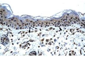 Immunohistochemical staining (Formalin-fixed paraffin-embedded sections) of human skin with IKZF5 polyclonal antibody  at 4-8 ug/mL working concentration.