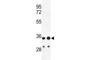 Western blot analysis of IGH antibody and HL-60, A2058 lysate.