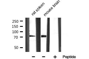 Western blot analysis of extracts of various sample,using MMP-9 Antibody.