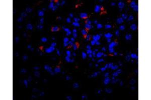 Image no. 2 for anti-Vascular Endothelial Growth Factor A (VEGFA) antibody (ABIN465273) (VEGFA antibody)