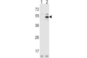 Western Blotting (WB) image for anti-Signal Transducing Adaptor Molecule (SH3 Domain and ITAM Motif) 1 (STAM) antibody (ABIN3001495)