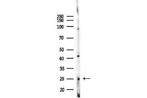 anti-Tryptophanyl-tRNA Synthetase (WARS) (Internal Region) antibody