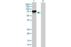 Western Blot analysis of CHEK2 expression in transfected 293T cell line by CHEK2 MaxPab polyclonal antibody. (CHEK2 antibody  (AA 1-543))