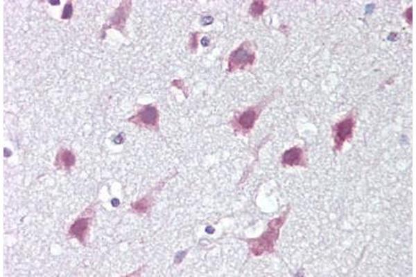 ZMYM3 antibody  (C-Term)