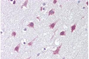 Anti-ZMYM3 antibody IHC staining of human brain, cortex. (ZMYM3 antibody  (C-Term))