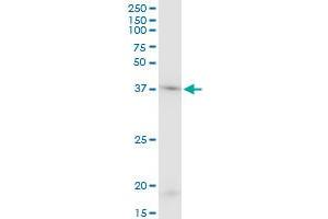ACTB monoclonal antibody (M03), clone 1E7. (beta Actin antibody  (AA 1-375))