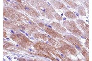 ABIN6267426 at 1/100 staining human Heart muscle tissue sections by IHC-P. (TNNI3 antibody  (pSer44))