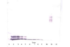 Image no. 4 for anti-Platelet Factor 4 (PF4) antibody (ABIN465152) (PF4 antibody)
