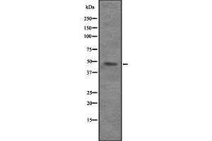 Western blot analysis of VPS4B expression in 293T whole cell lysate ,The lane on the left is treated with the antigen-specific peptide.