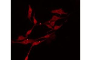 ABIN6274396 staining RAW264. (TTC23 antibody  (Internal Region))