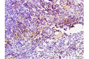 Formalin-fixed and paraffin embedded mouse colon carcinoma labeled with Anti-GPR49/LGR5 Polyclonal Antibody, Unconjugated  at 1:200 followed by conjugation to the secondary antibody and DAB staining.