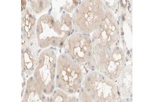 ABIN6277033 at 1/100 staining human kidney tissue sections by IHC-P. (PCK1 antibody  (C-Term))