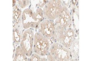 ABIN6277033 at 1/100 staining human kidney tissue sections by IHC-P.
