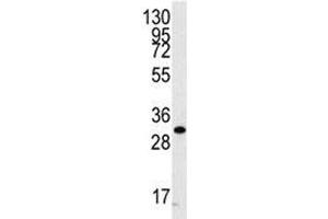 Western blot analysis of CDC2 antibody and A2058 cell lysate.
