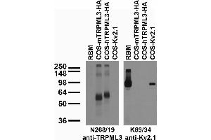 Tissue and transfected cell immunoblot: extracts of rat brain membranes (RBM) and of COS cells transiently transfected with HA-tagged mouse and human TRPML3 (mTRPML3 and hTRPML3) or untagged Kv2.