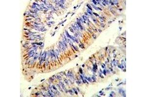 Immunohistochemistry (IHC) image for anti-Nuclear Factor-kB p65 (NFkBP65) (AA 10-37) antibody (ABIN3029810)