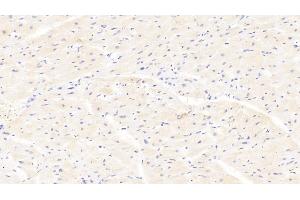 Detection of AMFR in Human Cardiac Muscle Tissue using Polyclonal Antibody to Autocrine Motility Factor Receptor (AMFR) (AMFR antibody  (AA 456-643))