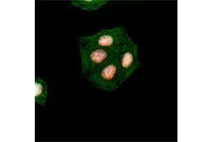 Immunofluorescence (IF) image for anti-H2A Histone Family, Member X (H2AFX) (pSer139) antibody (ABIN2666075) (H2AFX antibody  (pSer139))