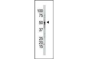 GCNT1 antibody  (C-Term)