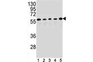 PAX1 antibody western blot analysis in (1) HepG2, (2) MDA-MB453, (3) 293, (4) K562 and (5) MCF-7 lysate. (PAX1 antibody  (AA 443-471))