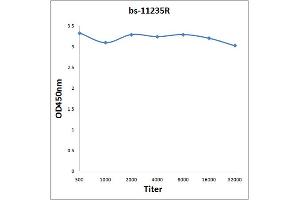 Antigen: 2 µg/100 µL Primary: Antiserum, 1:500, 1:1000, 1:2000, 1:4000, 1:8000, 1:16000, 1:32000; Secondary: HRP conjugated Rabbit Anti-Goat IgG at 1: 5000; TMB staining Read the data in Microplate Reader by 450nm. (GRK4/GRK5/GRK6 (AA 181-280) antibody)