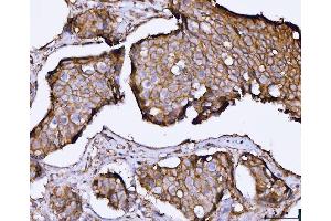IHC analysis of SNAP23 using anti-SNAP23 antibody (ABIN7599089). (SNAP23 antibody  (AA 1-211))