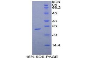 SDS-PAGE (SDS) image for Leukocyte Immunoglobulin-Like Receptor B3 (LILRB3) (AA 217-407) protein (His tag) (ABIN2125664)