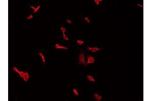 ABIN6266623 staining HepG2 by IF/ICC. (Peripherin antibody  (C-Term))