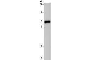 Gel: 8 % SDS-PAGE, Lysate: 40 μg, Lane: Human kidney tissue, Primary antibody: ABIN7191664(NMT1 Antibody) at dilution 1/200, Secondary antibody: Goat anti rabbit IgG at 1/8000 dilution, Exposure time: 3 minutes (NMT1 antibody)