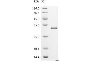 (Tris-Glycine gel) Discontinuous SDS-PAGE (reduced) with 5 % enrichment gel and 15 % separation gel.
