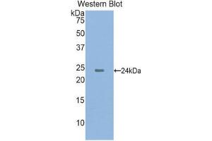 Western Blotting (WB) image for anti-Cathelicidin Antimicrobial Peptide (CAMP) (AA 31-170) antibody (Biotin) (ABIN1175686) (Cathelicidin antibody  (AA 31-170) (Biotin))
