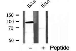 Western blot analysis of extracts of HeLa cells, using PYGL antibody. (PYGL antibody  (Internal Region))
