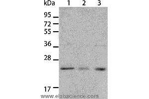 Western blot analysis of A431 and A172 cell, human liver cancer tissue, using BNIP1 Polyclonal Antibody at dilution of 1:550 (BNIP1 antibody)
