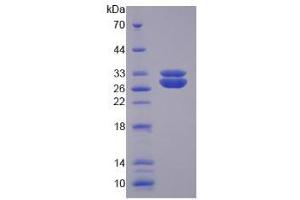 SDS-PAGE analysis of Human SOD3 Protein.