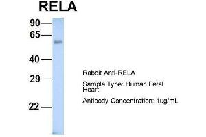 Host: Rabbit  Target Name: RELA  Sample Tissue: Human Fetal Heart  Antibody Dilution: 1. (NF-kB p65 antibody  (Middle Region))