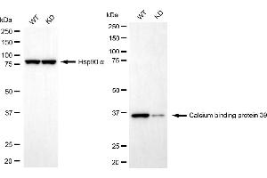 Western blotting analysis using calcium binding protein 39 antibody (ABIN7797828). (Recombinant CAB39 antibody)