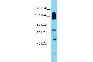 Host: Rabbit Target Name: SYDE2 Sample Type: Fetal Liver lysates Antibody Dilution: 1. (SYDE2 antibody  (C-Term))