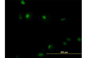 Immunofluorescence of monoclonal antibody to RUNX1 on HeLa cell. (RUNX1 antibody  (AA 210-310))