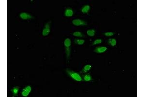 Immunofluorescent analysis of Hela cells using ABIN7151606 at dilution of 1:100 and Alexa Fluor 488-congugated AffiniPure Goat Anti-Rabbit IgG(H+L) (Emerin antibody  (AA 1-222))