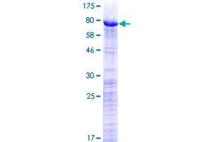 Image no. 1 for Pre-mRNA Processing Factor 31 (PRPF31) (AA 1-499) protein (GST tag) (ABIN1316389) (PRPF31 Protein (AA 1-499) (GST tag))