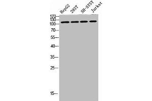 Western blot analysis of SW480 MCF7 lysate, antibody was diluted at 500. (DAAM1 antibody  (AA 400-500))