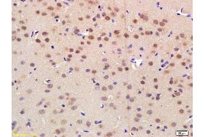 Formalin-fixed and paraffin embedded rat brain labeled with Rabbit Anti NRF-1 Polyclonal Antibody, Unconjugated (ABIN675219) at 1:200 followed by conjugation to the secondary antibody and DAB staining (NRF1 antibody  (AA 51-180))